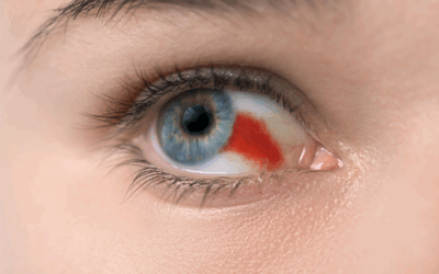 Yikes, is that blood in my eye?