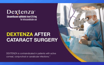 New Dextenza Reduces the Drop Regimen after Cataract Surgery