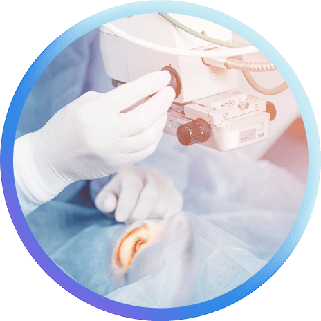 Cataract Surgery Circle Image Cataract Surgery Circle Image