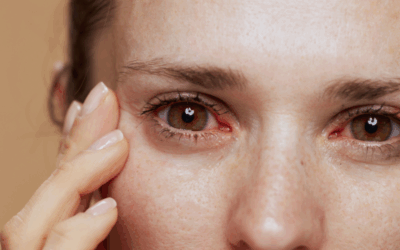 Dry Eye Disease Patients Have Options