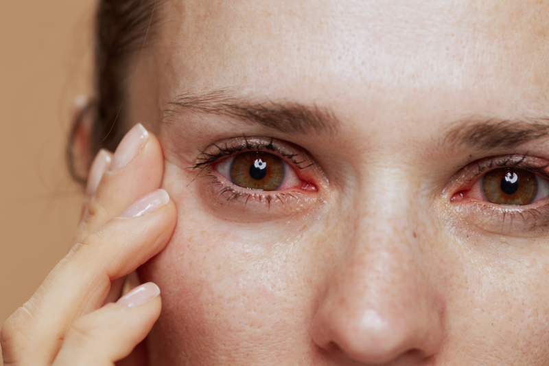 Dry Eye Disease Patients Have Options