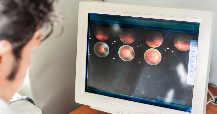 Macular Degeneration Macular Degeneration