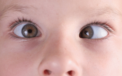 How Can Pediatric Strabismus Surgery Improve Your Child’s Vision?