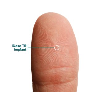 iDose TR image size