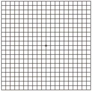 Amsler Grid Quad Cities Amsler Grid Example