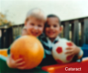 Cataracts Quad Cities Example of vision with Cataracts