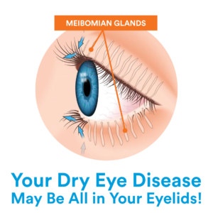 diagram of meibomian glands